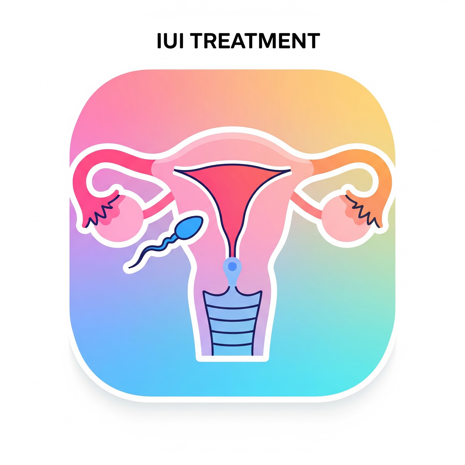 IUI Treatment