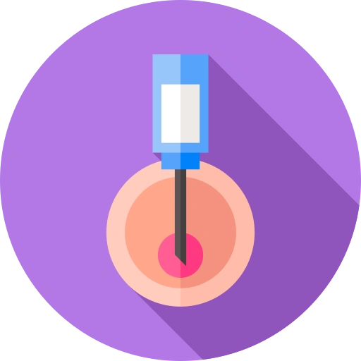 IVF Treatment