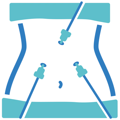Laparoscopic Surgery