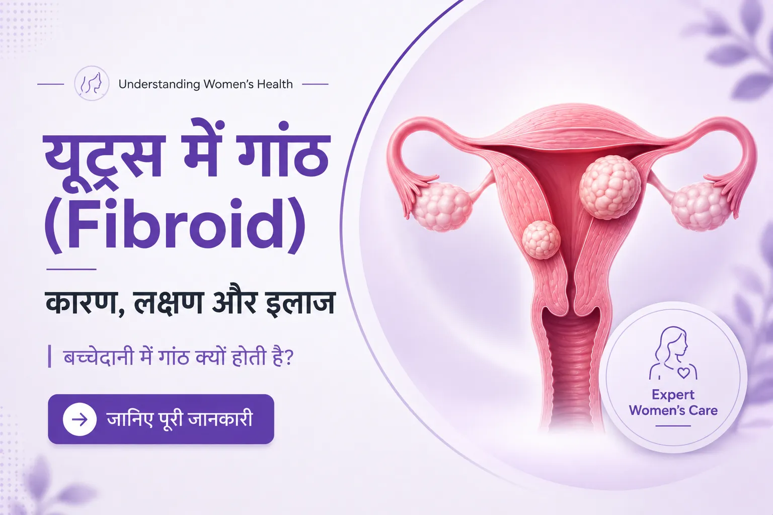 यूट्रस में गांठ (Fibroid) के कारण, लक्षण और इलाज | बच्चेदानी में गांठ क्यों होती है?